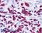 GLI Family Zinc Finger 3 antibody, LS-B73, Lifespan Biosciences, Immunohistochemistry paraffin image 