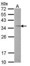 Thiosulfate Sulfurtransferase antibody, PA5-21733, Invitrogen Antibodies, Western Blot image 