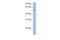 FAM20C Golgi Associated Secretory Pathway Kinase antibody, A04216, Boster Biological Technology, Western Blot image 