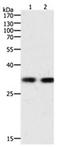 Hepatitis A Virus Cellular Receptor 1 antibody, orb107470, Biorbyt, Western Blot image 