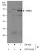 Checkpoint Kinase 2 antibody, GTX70100, GeneTex, Immunoprecipitation image 