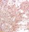 Peroxisome Proliferator Activated Receptor Gamma antibody, orb11291, Biorbyt, Immunohistochemistry paraffin image 