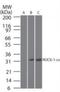 Rho Associated Coiled-Coil Containing Protein Kinase 1 antibody, NBP1-46006, Novus Biologicals, Western Blot image 