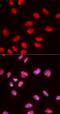 ETS Transcription Factor ELK1 antibody, FNab02738, FineTest, Immunofluorescence image 