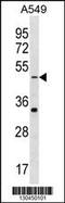 Gamma-Aminobutyric Acid Type A Receptor Rho2 Subunit antibody, 60-013, ProSci, Western Blot image 