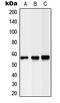 Lipase C, Hepatic Type antibody, LS-B13578, Lifespan Biosciences, Western Blot image 