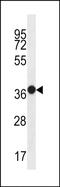 Mucin 15, Cell Surface Associated antibody, PA5-48498, Invitrogen Antibodies, Western Blot image 