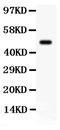 Serum/Glucocorticoid Regulated Kinase 1 antibody, PB9434, Boster Biological Technology, Western Blot image 