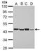 Proteasome 26S Subunit, Non-ATPase 6 antibody, PA5-30333, Invitrogen Antibodies, Western Blot image 