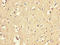 Matrix Gla Protein antibody, LS-C369973, Lifespan Biosciences, Immunohistochemistry paraffin image 