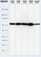 ATP Synthase F1 Subunit Alpha antibody, ab14748, Abcam, Western Blot image 