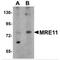 MRE11 Homolog, Double Strand Break Repair Nuclease antibody, MBS150224, MyBioSource, Western Blot image 