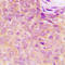 Ubiquitin Like Modifier Activating Enzyme 5 antibody, LS-C358380, Lifespan Biosciences, Immunohistochemistry paraffin image 