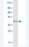 Spectrin Repeat Containing Nuclear Envelope Protein 1 antibody, H00023345-M02, Novus Biologicals, Western Blot image 