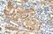 GDP-Mannose Pyrophosphorylase B antibody, NBP1-55168, Novus Biologicals, Immunohistochemistry paraffin image 