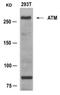 ATM Serine/Threonine Kinase antibody, 79-558, ProSci, Western Blot image 
