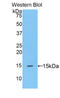 Peroxisome Proliferator Activated Receptor Delta antibody, LS-C301232, Lifespan Biosciences, Western Blot image 