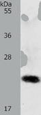 RAB22A, Member RAS Oncogene Family antibody, TA321881, Origene, Western Blot image 