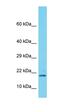 SPT4 Homolog, DSIF Elongation Factor Subunit antibody, orb324615, Biorbyt, Western Blot image 