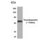 Thrombopoietin antibody, NBP2-11922, Novus Biologicals, Western Blot image 