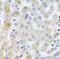 Eukaryotic Translation Initiation Factor 3 Subunit M antibody, FNab02714, FineTest, Immunohistochemistry paraffin image 