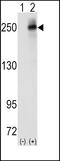 ALK Receptor Tyrosine Kinase antibody, 63-027, ProSci, Western Blot image 