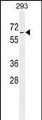 Inactive phosphatidylcholine-hydrolyzing phospholipase D5 antibody, PA5-35057, Invitrogen Antibodies, Western Blot image 