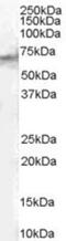 Signal Transducing Adaptor Molecule 2 antibody, NB100-2838, Novus Biologicals, Western Blot image 