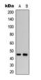 WW Domain Containing Oxidoreductase antibody, orb393188, Biorbyt, Western Blot image 