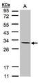 NADH:Ubiquinone Oxidoreductase Core Subunit V2 antibody, PA5-21432, Invitrogen Antibodies, Western Blot image 