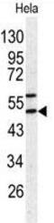 Serpin Family H Member 1 antibody, GTX81503, GeneTex, Western Blot image 