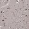 Kelch Domain Containing 3 antibody, PA5-56360, Invitrogen Antibodies, Immunohistochemistry frozen image 