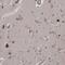 Kelch Domain Containing 3 antibody, PA5-56360, Invitrogen Antibodies, Immunohistochemistry frozen image 