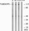 Tubulin Gamma Complex Associated Protein 5 antibody, LS-C119995, Lifespan Biosciences, Western Blot image 