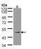Squalene synthase antibody, PA5-28912, Invitrogen Antibodies, Western Blot image 
