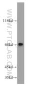 Protein Only RNase P Catalytic Subunit antibody, 20959-1-AP, Proteintech Group, Western Blot image 