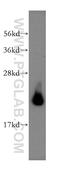Adaptor Related Protein Complex 3 Subunit Sigma 2 antibody, 15319-1-AP, Proteintech Group, Western Blot image 
