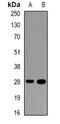 Small heterodimer partner antibody, orb381917, Biorbyt, Western Blot image 