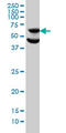 Ribosomal Protein S6 Kinase B1 antibody, LS-B6145, Lifespan Biosciences, Western Blot image 