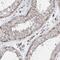 Transmembrane And Coiled-Coil Domains 6 antibody, PA5-57962, Invitrogen Antibodies, Immunohistochemistry paraffin image 