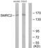 SWI/SNF Related, Matrix Associated, Actin Dependent Regulator Of Chromatin Subfamily C Member 2 antibody, abx013711, Abbexa, Western Blot image 