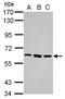Zinc Finger Protein 189 antibody, GTX117129, GeneTex, Western Blot image 