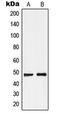 G Protein-Coupled Receptor 19 antibody, GTX55148, GeneTex, Western Blot image 