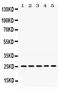 Progesterone Receptor Membrane Component 1 antibody, PB9775, Boster Biological Technology, Western Blot image 