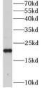 RAP1B, Member Of RAS Oncogene Family antibody, FNab07109, FineTest, Western Blot image 