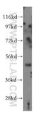 Myosin Regulatory Light Chain Interacting Protein antibody, 15455-1-AP, Proteintech Group, Western Blot image 