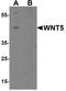 Wnt Family Member 5B antibody, A05836, Boster Biological Technology, Western Blot image 