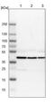 N-Myc Downstream Regulated 1 antibody, PA5-51540, Invitrogen Antibodies, Western Blot image 