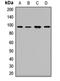 Dystroglycan 1 antibody, orb411663, Biorbyt, Western Blot image 