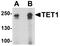 Tet Methylcytosine Dioxygenase 1 antibody, PA5-72805, Invitrogen Antibodies, Western Blot image 